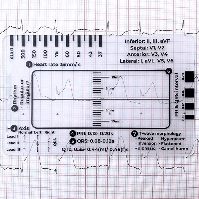 (🔥HOT SALE NOW 60% OFF) -ECG 7 Step Ruler