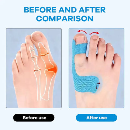 👣Pre-cut Bunion Corrector Kinesiology Tape