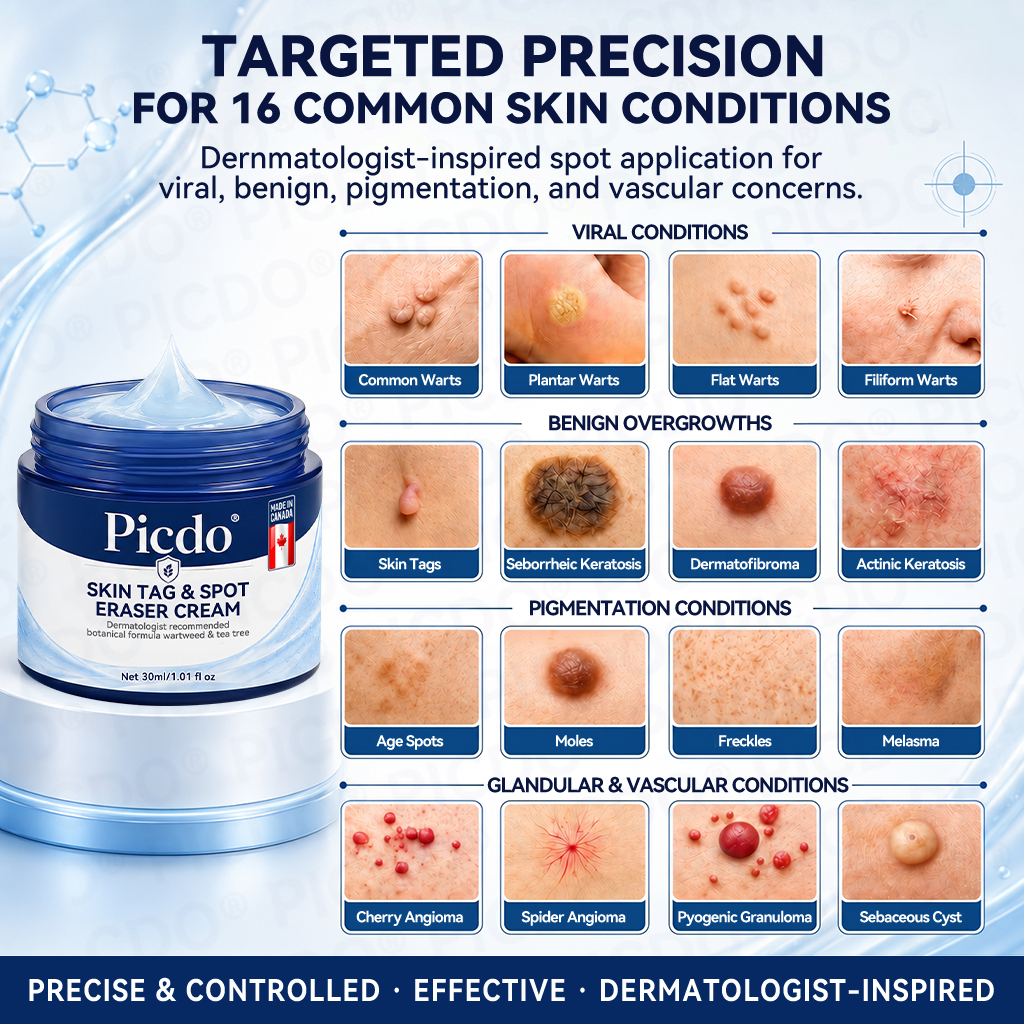 𝐏𝐢𝐜𝐝𝐨® 7-𝐃𝐚𝐲 𝐒𝐤𝐢𝐧 𝐓𝐚𝐠 & 𝐒𝐩𝐨𝐭 𝐄𝐫𝐚𝐬𝐞𝐫 𝐂𝐫𝐞𝐚𝐦 (Zero Pain, Zero 𝐒𝐜𝐚𝐫𝐬 Formula) 🎉