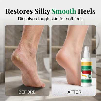 Hot🔥-Refreshing Foot Care Spray with Herbal Formula